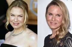 Zellweger